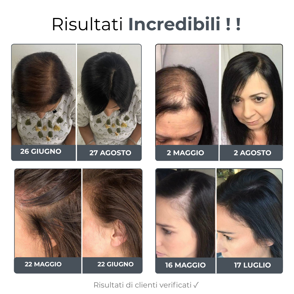 Micro Infusione Rivitalizzante Capelli + Siero extra offerto